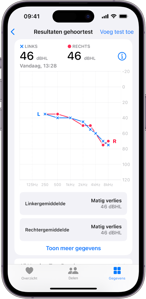 Een audiogram op een iPhone waarop te zien is dat er in beide oren sprake is van matig gehoorverlies.