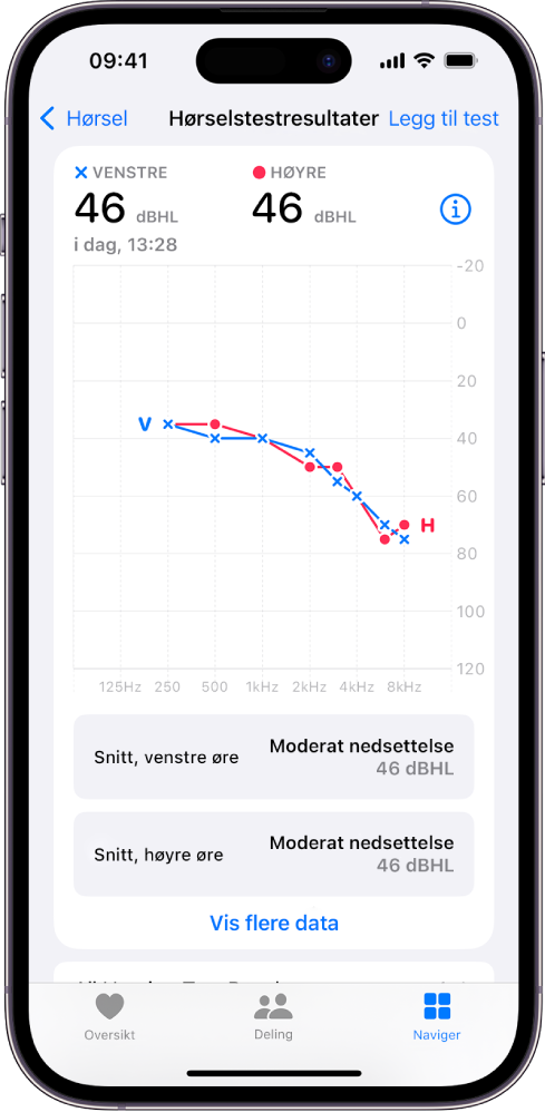 Et audiogram på iPhone som viser moderat hørselstap i begge ørene.