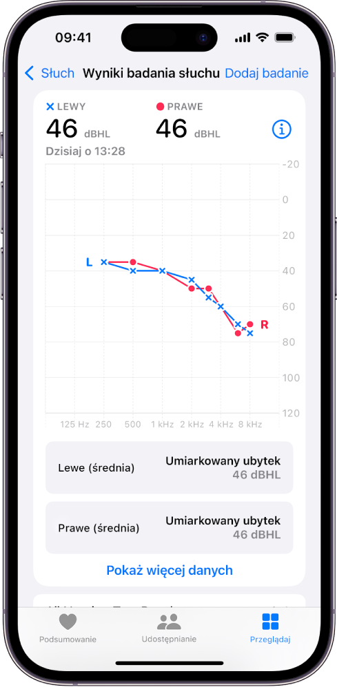 Um audiograma no iPhone, a mostrar perda auditiva moderada em ambos os ouvidos.