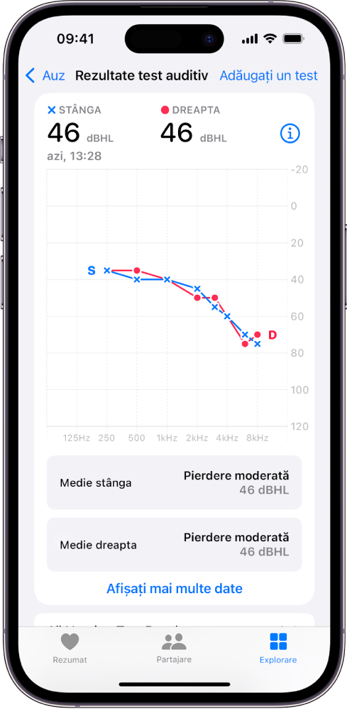 O audiogramă pe iPhone, indicând o pierdere moderată a auzului în ambele urechi.