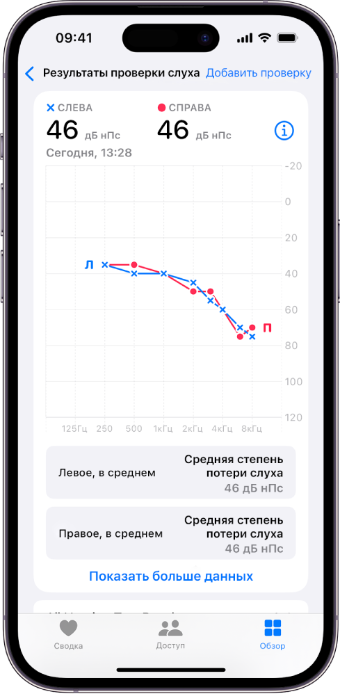 Аудиограмма на iPhone, показывающая умеренную потерю слуха на оба уха.