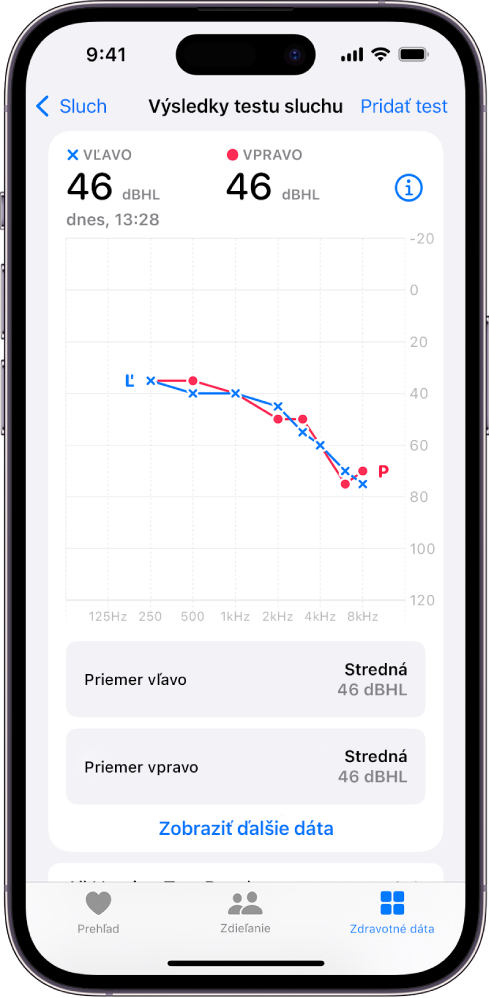 Audiogram na iPhone, ktorý zobrazuje strednú stratu sluchu pre obe uši.