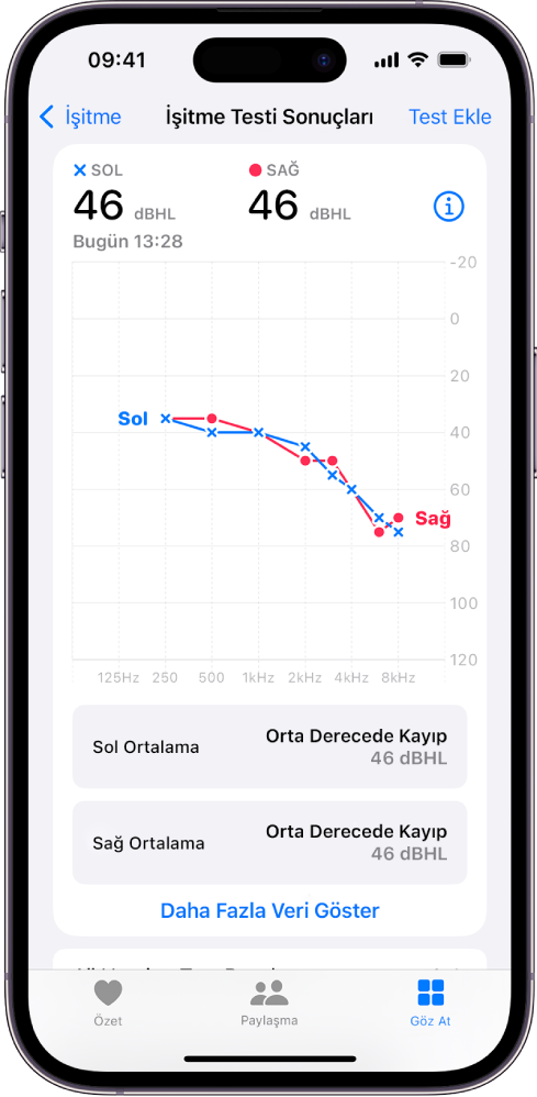 iPhone’daki bir odyogram, iki kulakta orta dereceli işitme kaybını gösteriyor.