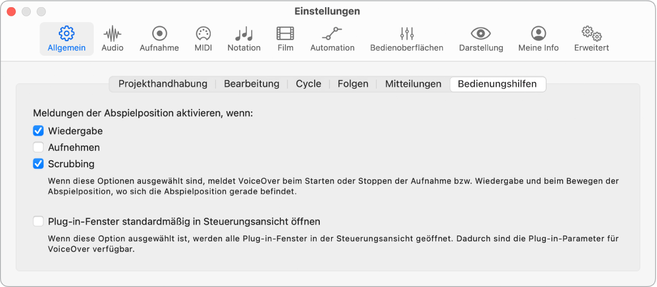 Abbildung. Einstellungsbereich „Allgemein“ > „Bedienungshilfen“.