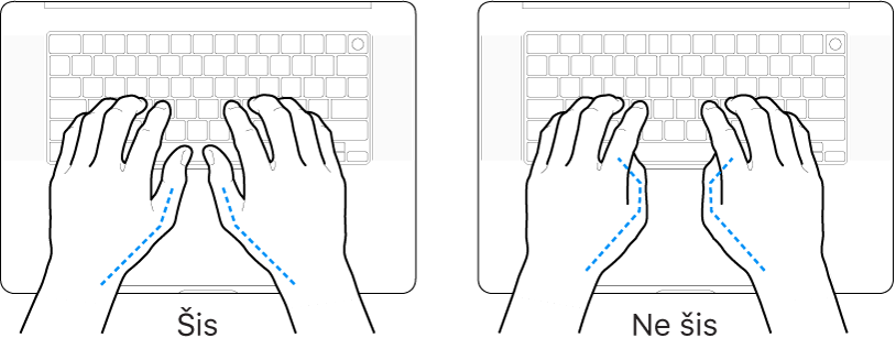 Rokas novietotas virs tastatūras, parādot pareizu un nepareizu īkšķu novietojumu.