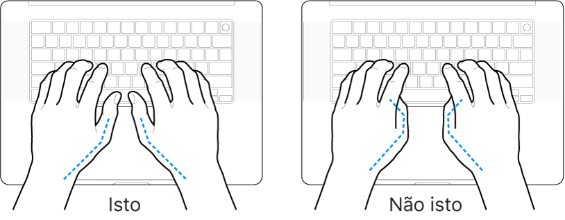 Mãos posicionadas sobre um teclado, mostrando os alinhamentos correto e incorreto dos polegares.