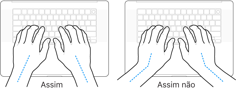 As mãos posicionadas sobre um teclado a mostrar alinhamentos corretos e incorretos das mãos e dos pulsos.