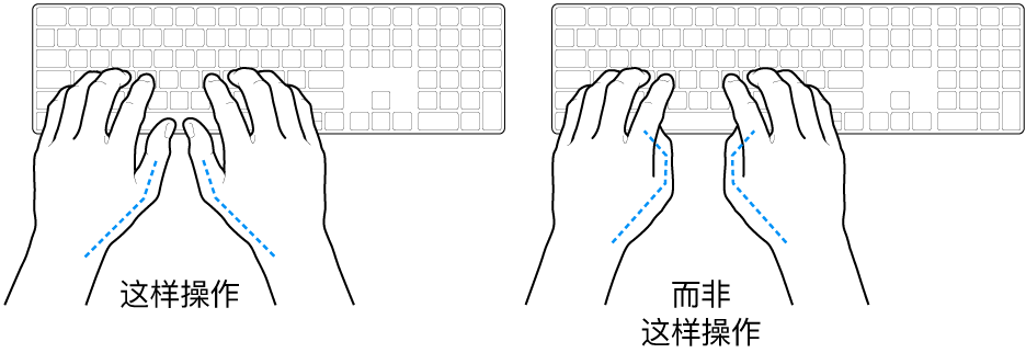手掌放在键盘上方,显示拇指的正确放置和错误放置。