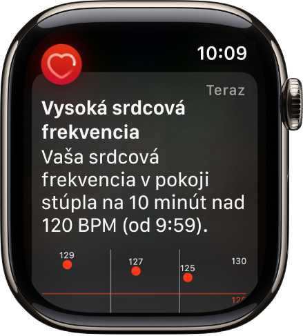 Obrazovka Upozornenie o srdcovej frekvencii indikuje zistenie vysokej srdcovej frekvencie.