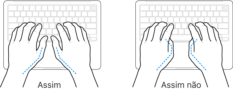 As mãos posicionadas sobre um teclado a mostrar a colocação correta e incorreta dos polegares.