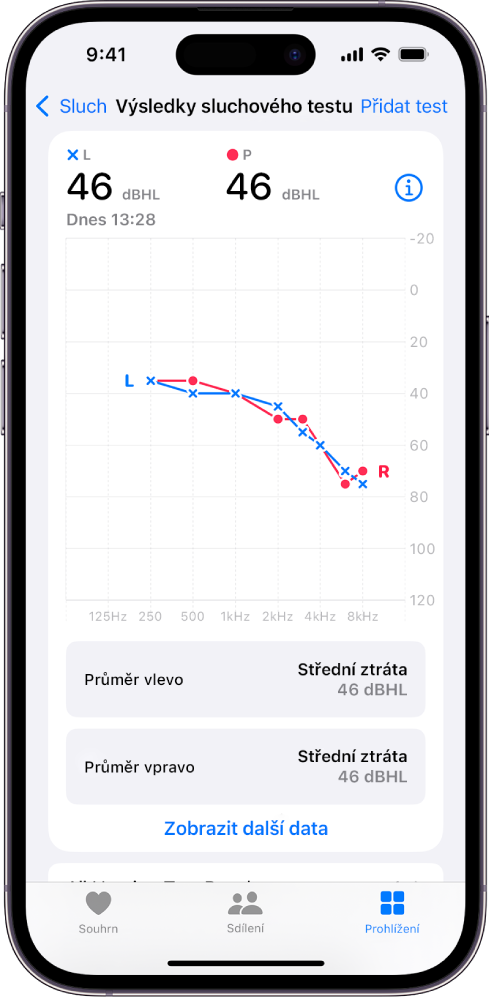 Audiogram na iPhonu ukazující na středně těžké poškození sluchu u obou uší