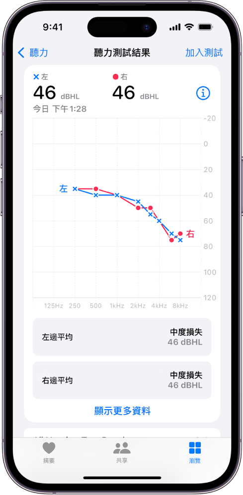 iPhone 上的聽力圖,顯示兩邊耳朵都有中度聽力受損。