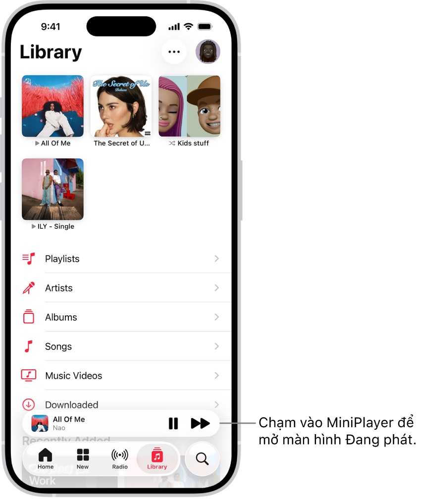 Tab Thư viện, đang hiển thị MiniPlayer ở gần dưới cùng. MiniPlayer hiển thị tiêu đề của bài hát đang phát. Các nút Tạm dừng và Bài tiếp theo nằm bên phải tiêu đề bài hát. Chạm vào MiniPlayer để mở màn hình Đang phát.