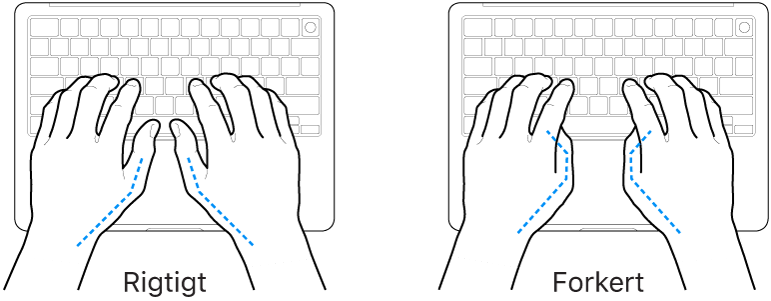 Hænder anbragt over et tastatur med rigtig og forkert position af tommelfingre.
