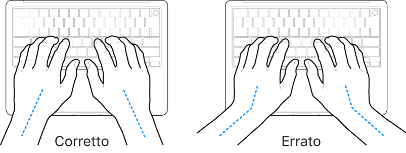 Mani posizionate su una tastiera che illustrano l’allineamento corretto ed errato di polso e mano.