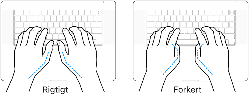Hænder anbragt over et tastatur med rigtig og forkert position af tommelfingre.