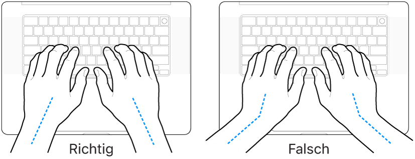 Tastatur und Hände in richtiger und falscher Haltung von Handgelenk und Händen