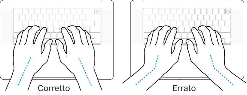 Mani posizionate su una tastiera che illustrano l'allineamento corretto ed errato di polso e mano.
