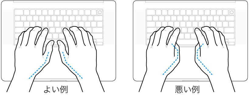 キーボードに置かれた手。親指の適切な位置と不適切な位置を示しています。