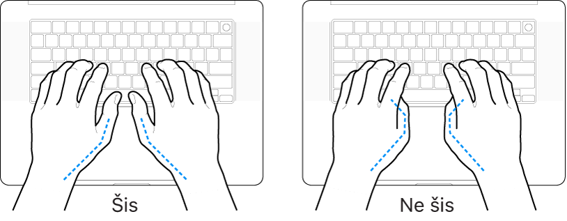 Rokas novietotas virs tastatūras, parādot pareizu un nepareizu īkšķu novietojumu.