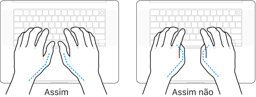 As mãos posicionadas sobre um teclado a mostrar a colocação correta e incorreta dos polegares.