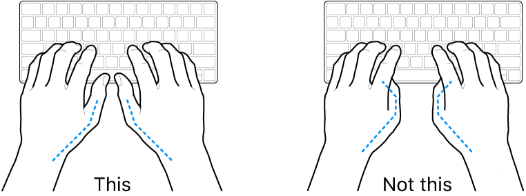 Hands positioned over a keyboard, showing correct and incorrect placement of thumbs.