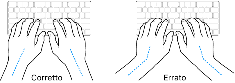 Mani posizionate su una tastiera che illustrano l'allineamento corretto ed errato di polso e mano.