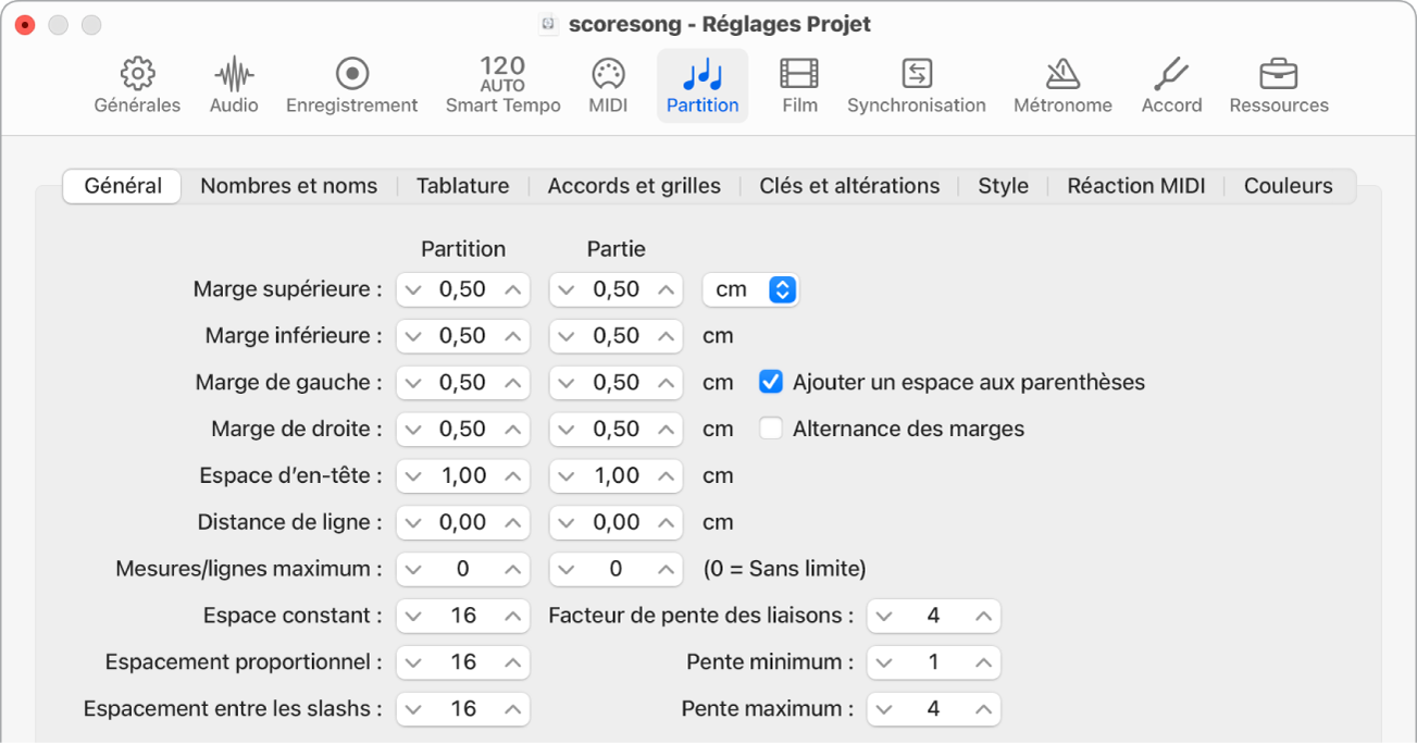 Figure. Sous-fenêtre Global des réglages de partition du projet