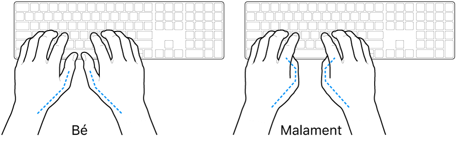 Unes mans posades sobre un teclat mostrant la posició correcta i incorrecta dels polzes.