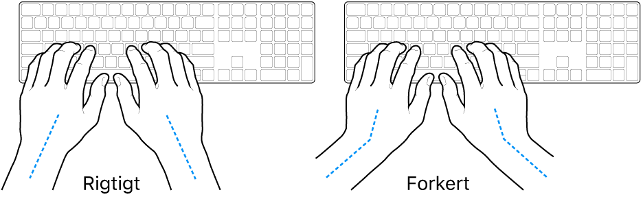 Hænder anbragt over et tastatur med rigtig og forkert position af håndled og hånd.