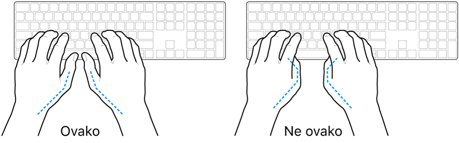 Ruke položene na tipkovnicu s prikazom pravilnog i nepravilnog položaja palaca.
