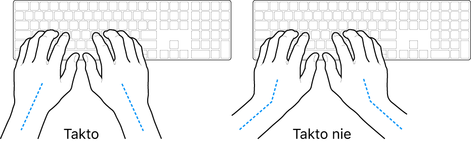 Ruky položené na klávesnici znázorňujúce správnu a nesprávnu polohu zápästia a ruky.