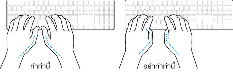 มือวางอยู่เหรือแป้นพิมพ์ แสดงตำแหน่งการวางนิ้วหัวแม่มือที่ถูกต้องและไม่ถูกต้อง