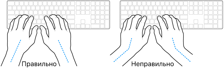 Руки розташовано над клавіатурою й показано правильне та неправильне положення кистей і рук.