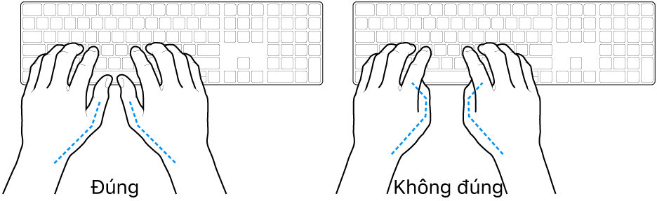 Các bàn tay đặt phía trên bàn phím, minh họa cách đặt ngón cái đúng và sai.