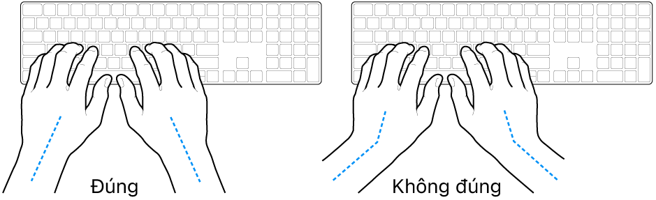 Các bàn tay đặt phía trên bàn phím, minh họa cách đặt cổ tay và bàn tay đúng và sai.