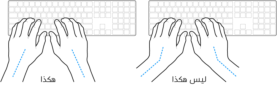 يدان موضوعتان على لوحة مفاتيح، وتظهر المحاذاة الصحيحة وغير الصحيحة للمعصم واليد.