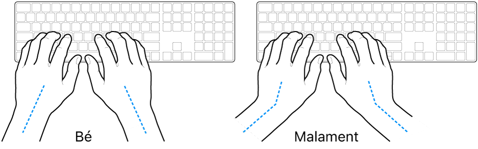Unes mans posades sobre un teclat mostrant l’alineació correcta i incorrecta del canell i la mà.