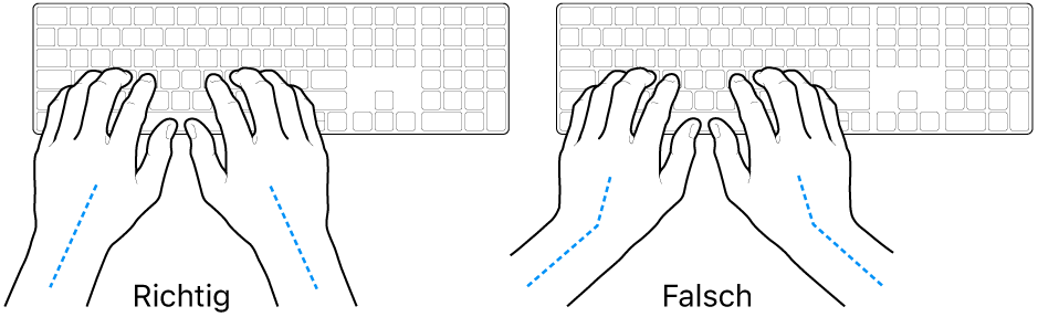 Tastatur und Hände in richtiger und falscher Haltung von Handgelenk und Händen