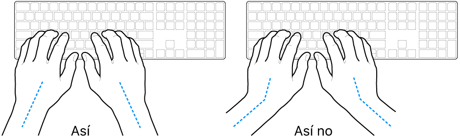 Manos colocadas sobre un teclado que muestran una alineación correcta e incorrecta de la muñeca y la mano.