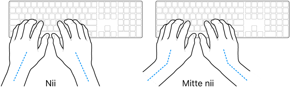 Klaviatuurile paigutatud käed, mis näitavad õiget ja valet randme ja käe joondust.