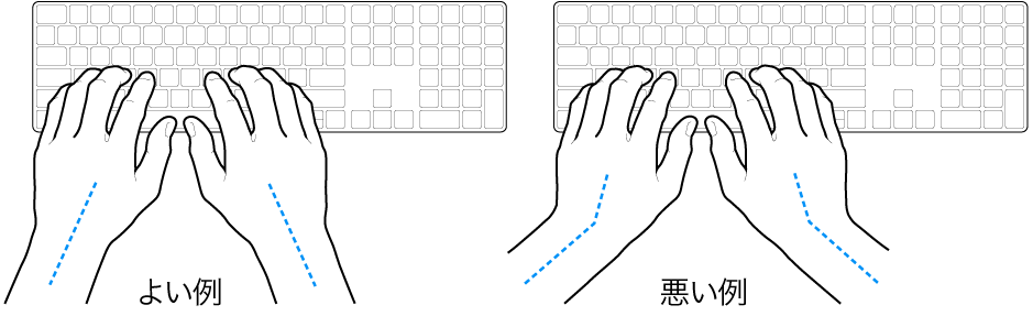キーボードに置かれた手。手首と手の適切な位置関係と不適切な位置関係を示しています。