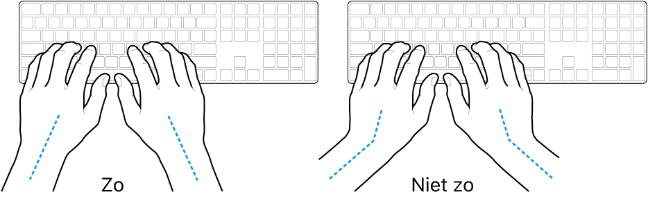 Handen boven een toetsenbord, waarbij de goede en verkeerde stand van de handen en polsen wordt aangegeven.