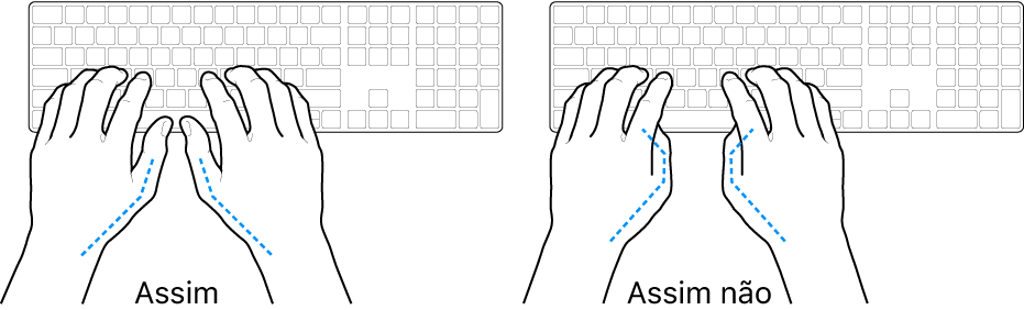 As mãos posicionadas sobre um teclado a mostrar a colocação correta e incorreta dos polegares.