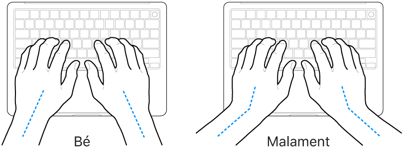Unes mans posades sobre un teclat mostrant l’alineació correcta i incorrecta del canell i la mà.