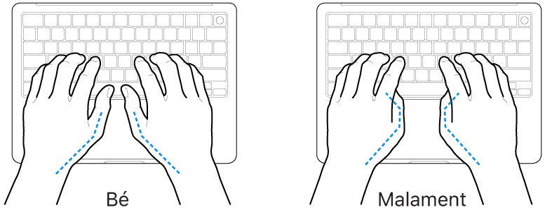 Unes mans posades sobre un teclat mostrant la posició correcta i incorrecta dels polzes.