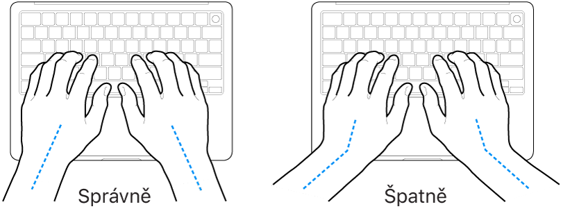 Ruce nad klávesnicí znázorňující správnou a nesprávnou polohu zápěstí