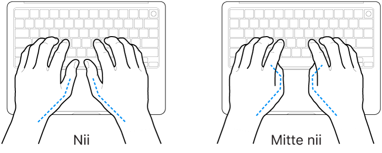 Klaviatuurile paigutatud käed, mis näitavad õiget ja valet pöidlate joondust.