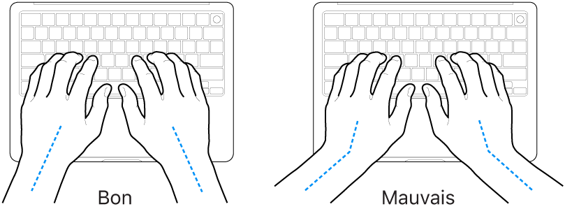 Mains placées sur un clavier, montrant le bon et le mauvais alignement des poignets et des mains.