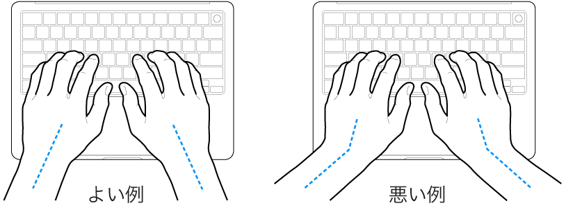 キーボードに置かれた手。手首と手の適切な位置関係と不適切な位置関係を示しています。
